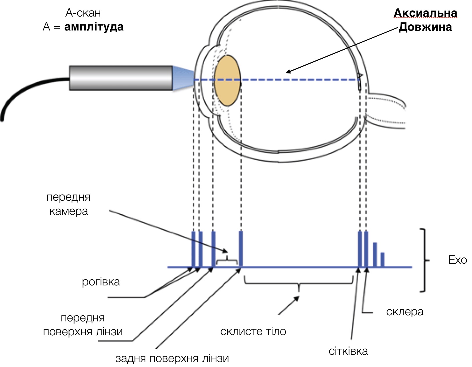 a-scan basics.jpg
