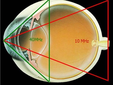 b-scan frequency.jpg