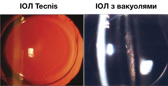 tecnis1.jpg