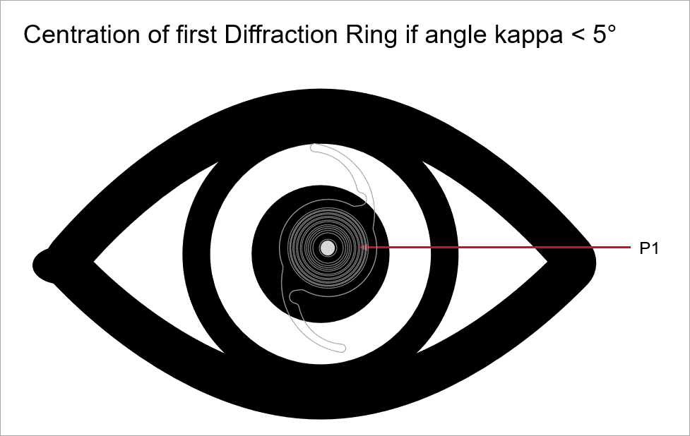 centration1.png