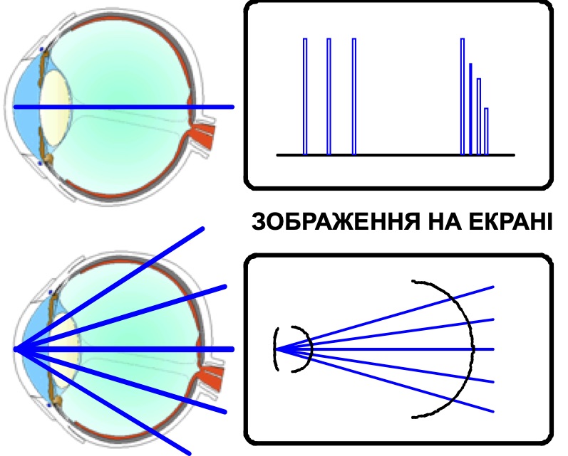 opthalmic ultrasound.jpg