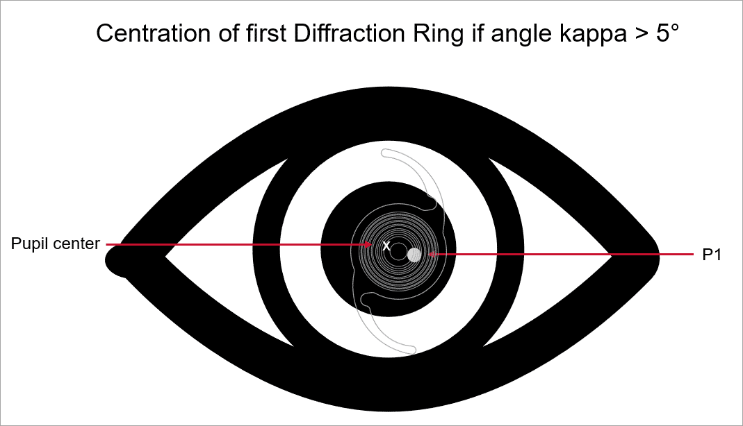 centration2.png