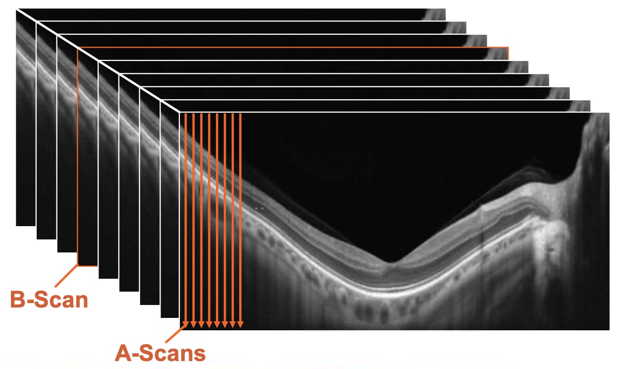 ab-scans.jpg