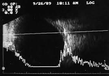 b-scan 2.jpg