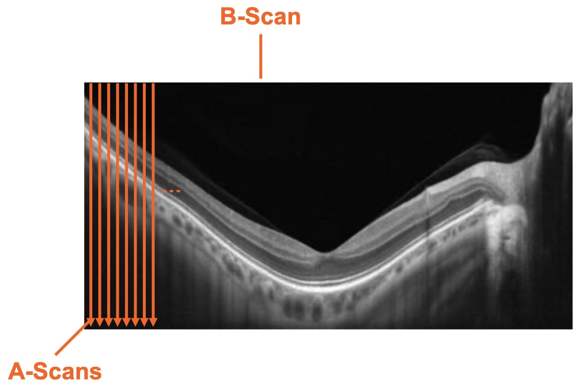 b-scanS.jpg
