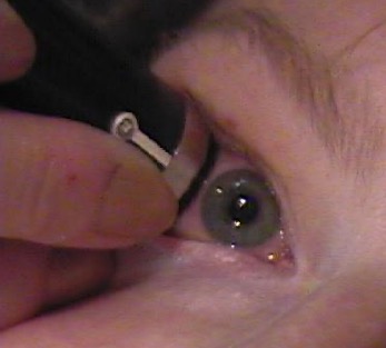 probe marker.jpg