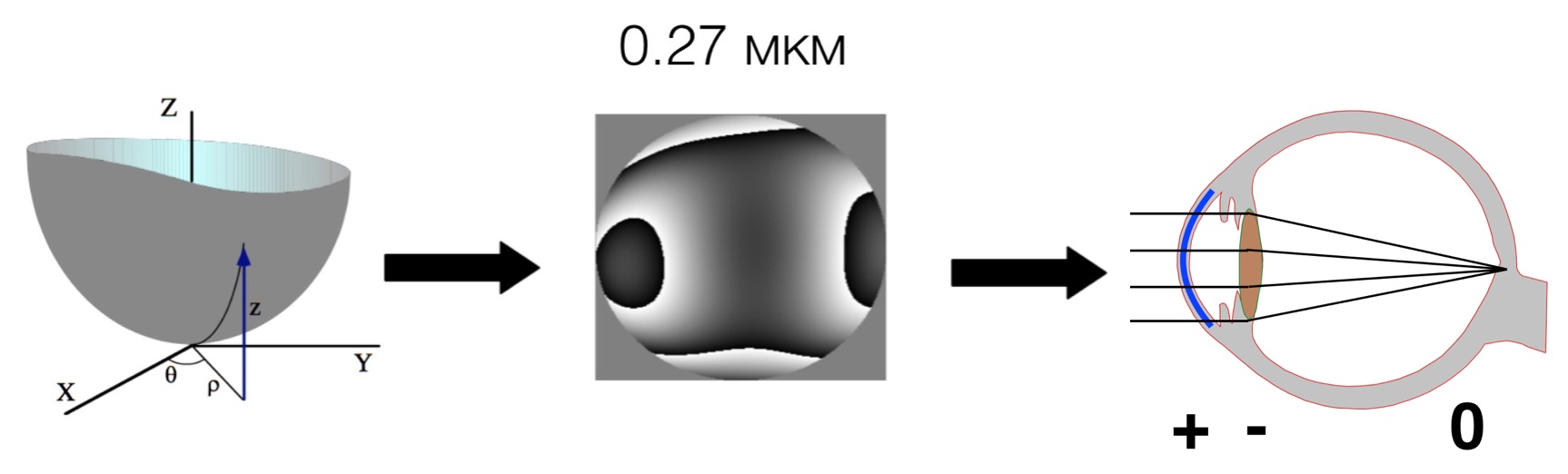 tecnis_027_2.jpg