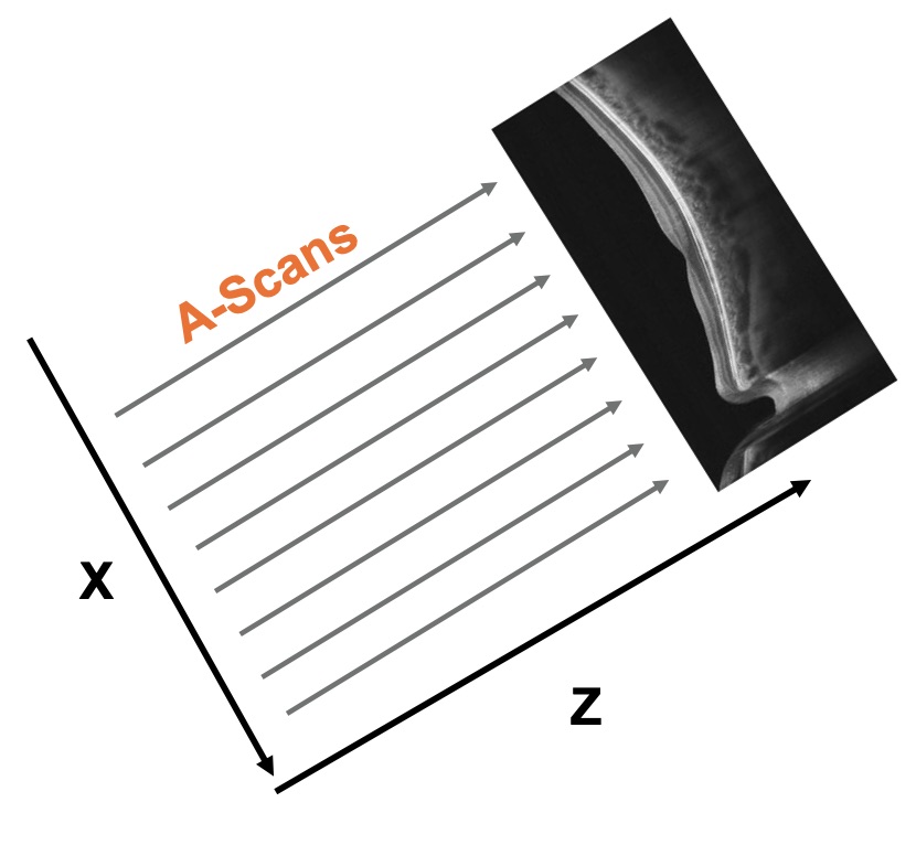 b-scan.jpg