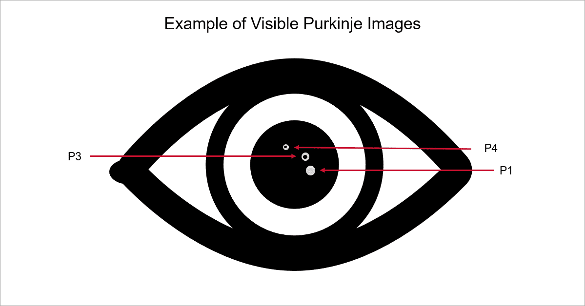 purkinjeexamples.png